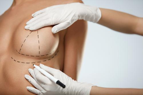 Nipple Surgery San Antonio, TX