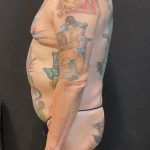 Butt Implants Before & After Patient #6846