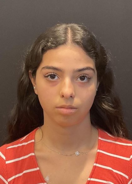 Rhinoplasty Before & After Patient #6699