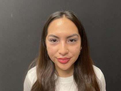 Liquid Rhinoplasty Before & After Patient #8077