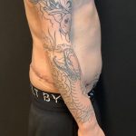 Body Lift Before & After Patient #8098