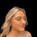 Liquid Rhinoplasty Before & After Patient #8076