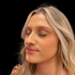 Liquid Rhinoplasty Before & After Patient #8076