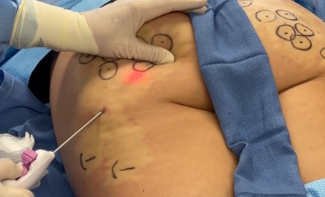 Lower Body Rejuvenation article image