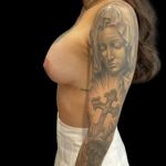 Breast Lift Before & After Patient #5398