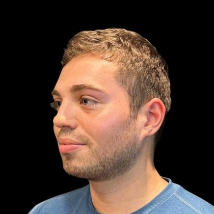 Rhinoplasty Before & After Patient #8159