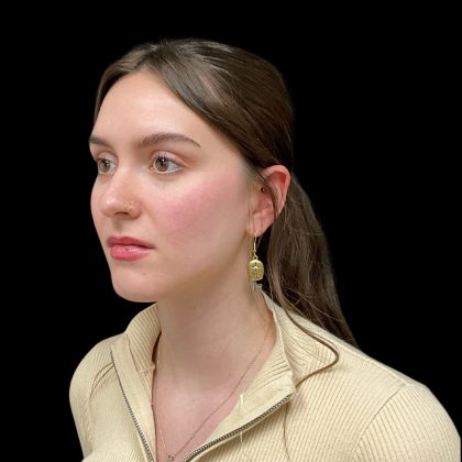 Rhinoplasty Before & After Patient #10847