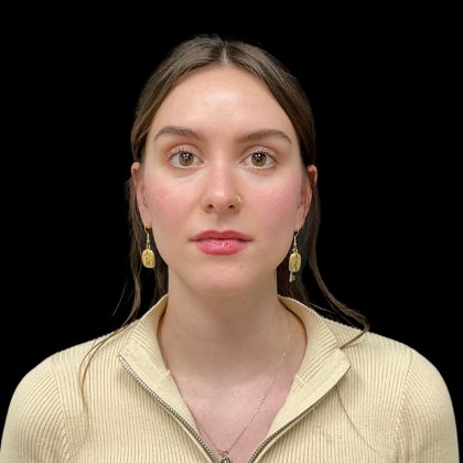 Rhinoplasty Before & After Patient #10847