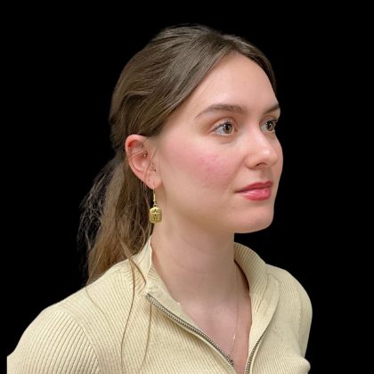 Rhinoplasty Before & After Patient #10847