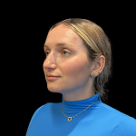 Rhinoplasty Before & After Patient #11186