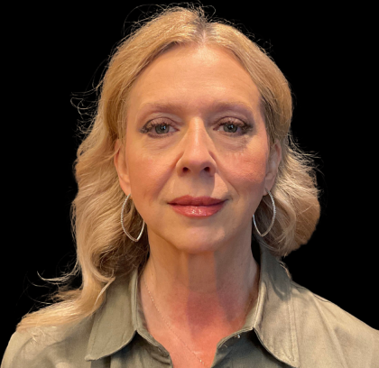 Brow Lift Before & After Patient #12048