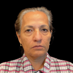 Blepharoplasty Before & After Patient #12227