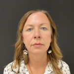 Blepharoplasty Before & After Patient #12228