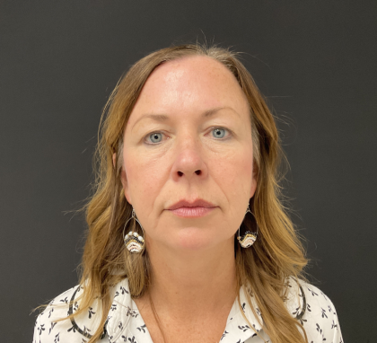 Blepharoplasty Before & After Patient #12228